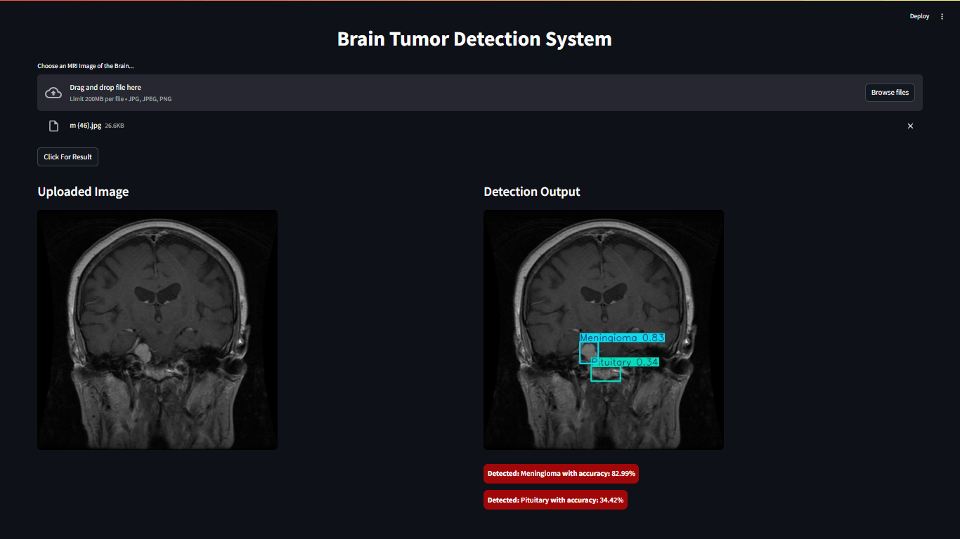 Brain Tumor Detection
